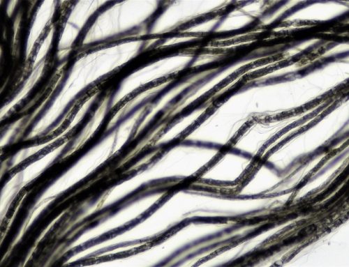 Can one nerve treat disease and change how you feel?